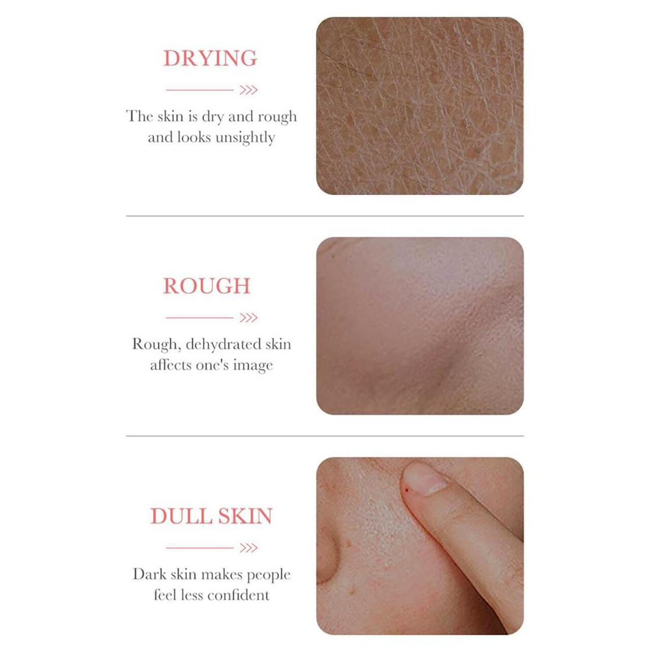 Esencia de Rosa con Ácido Hialurónico – Hidratación, Nutrición y Luminosidad en 30 ml