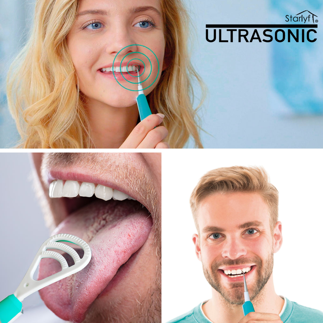 Limpiador Dental con Vibración de Alta Frecuencia para Limpieza Profunda y Efectiva