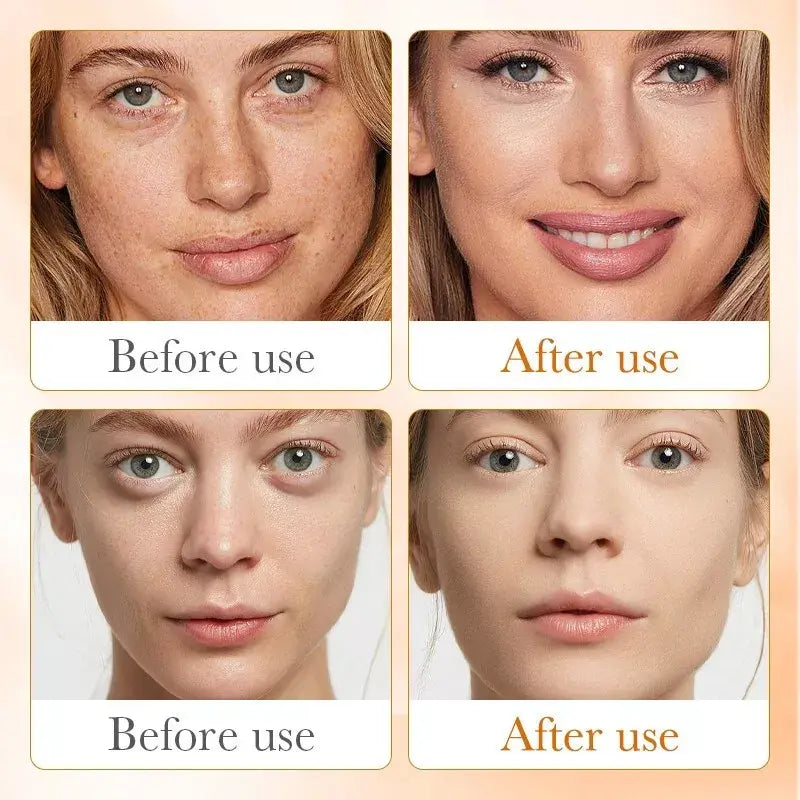 Sérum de Vitamina C SADOER 100 ml – Ilumina, Hidrata y Rejuvenece Tu Piel