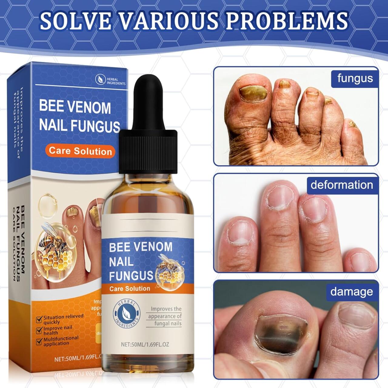Sérum para Uñas con Veneno de Abeja 50ml – Tratamiento Antihongos y Cuidado Intensivo