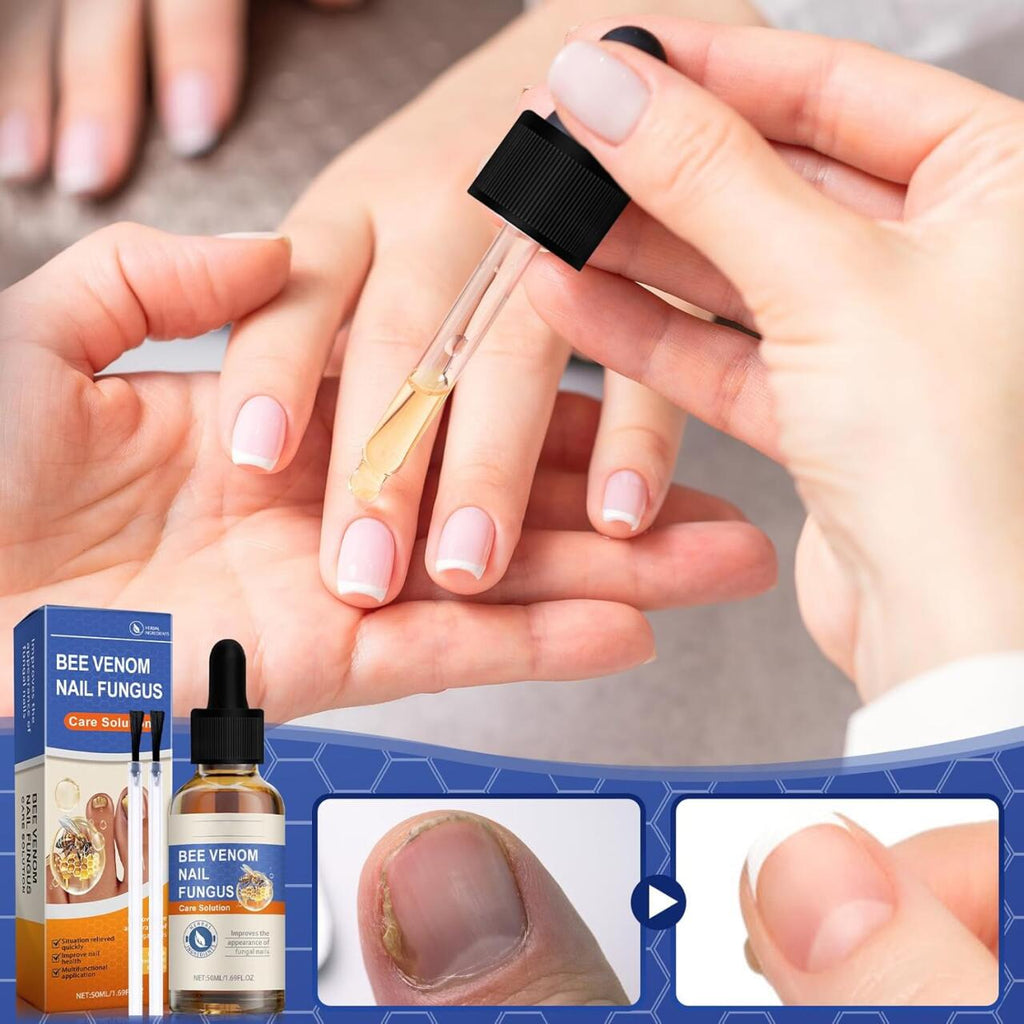 Sérum para Uñas con Veneno de Abeja 50ml – Tratamiento Antihongos y Cuidado Intensivo